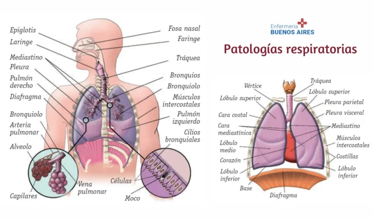 Patologías respiratorias más frecuentes