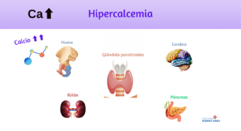 Guía completa sobre la hipercalcemia: causas, síntomas y tratamiento