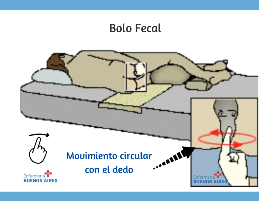 Bolo Fecal 