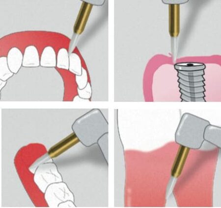 Urgencia dental
