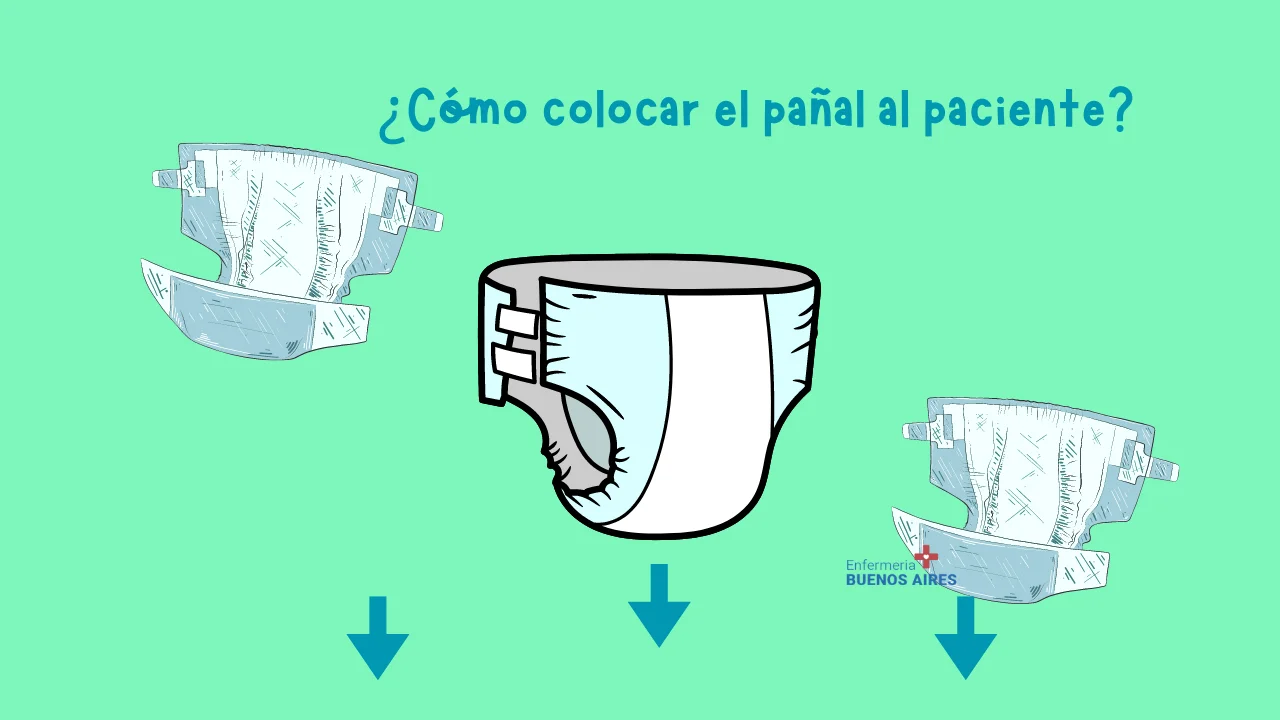 ¿Cómo colocar el pañal al paciente?