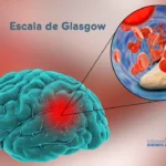 Escala de Glasgow: Evaluación Neurológica