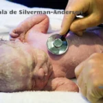 Escala de Silverman-Andersen: Valoración del Grado de Dificultad Respiratoria en Recién Nacidos