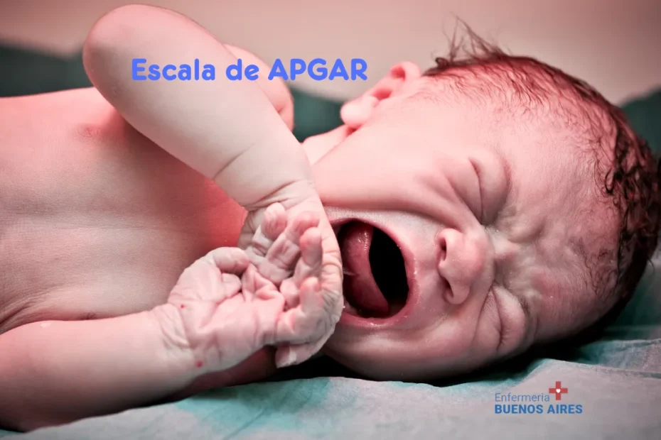 Escala APGAR