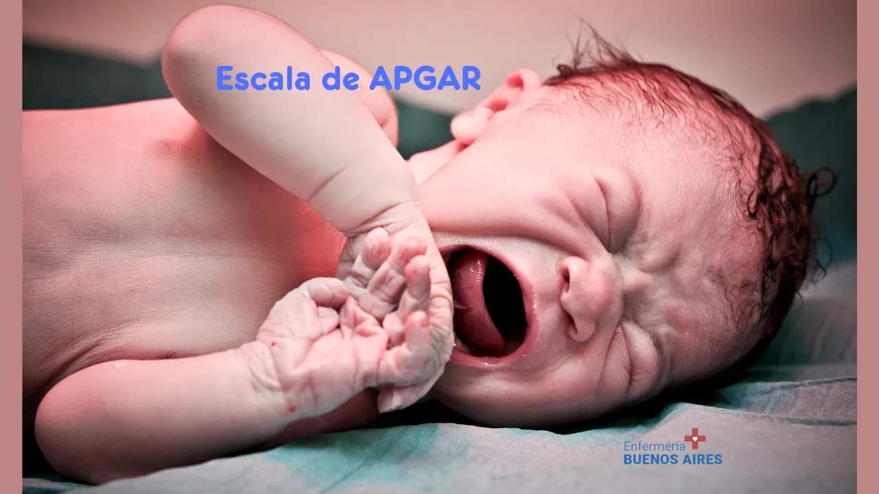 Escala APGAR