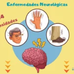 14 Curiosidades de Enfermedades Neurológicas